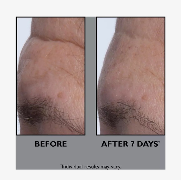 Peter Thomas Roth FIRMx Collagen Serum - Picture 4 of 6